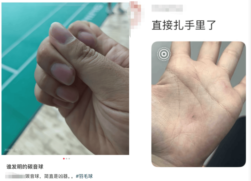 击穿眉骨、扎穿手指……这项球速达300km/h的人气运动暗藏风险！